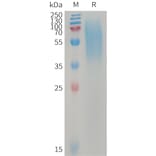 SDS-PAGE - Recombinant Human LYPD3 Protein (6×His Tag) (A317744) - Antibodies.com