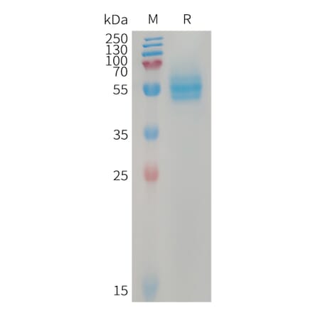 SDS-PAGE - Recombinant Human CD14 Protein (7×His Tag) (A317745) - Antibodies.com