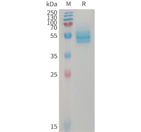 SDS-PAGE - Recombinant Human CD14 Protein (6×His Tag) (A317746) - Antibodies.com