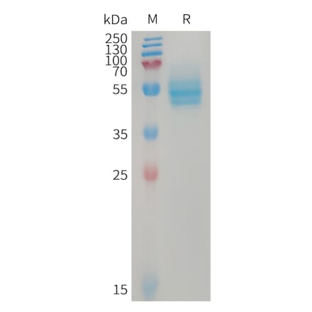 SDS-PAGE - Recombinant Human CD14 Protein (6×His Tag) (A317746) - Antibodies.com