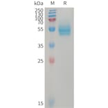 SDS-PAGE - Recombinant Human CD14 Protein (6×His Tag) (A317746) - Antibodies.com