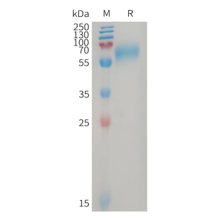 SDS-PAGE - Recombinant Human GPR56 Protein (6×His Tag) (A317747) - Antibodies.com