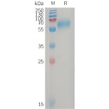 SDS-PAGE - Recombinant Human GPR56 Protein (6×His Tag) (A317747) - Antibodies.com