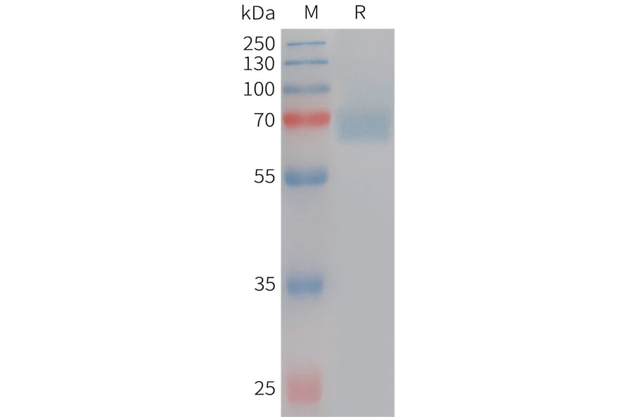 SDS-PAGE - Recombinant Human Acetylcholinesterase Protein (6×His Tag) (A317748) - Antibodies.com