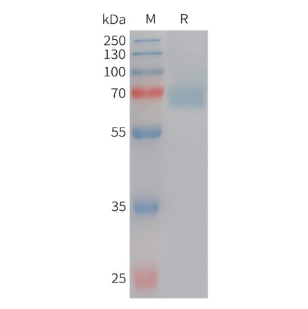 SDS-PAGE - Recombinant Human Acetylcholinesterase Protein (6×His Tag) (A317748) - Antibodies.com