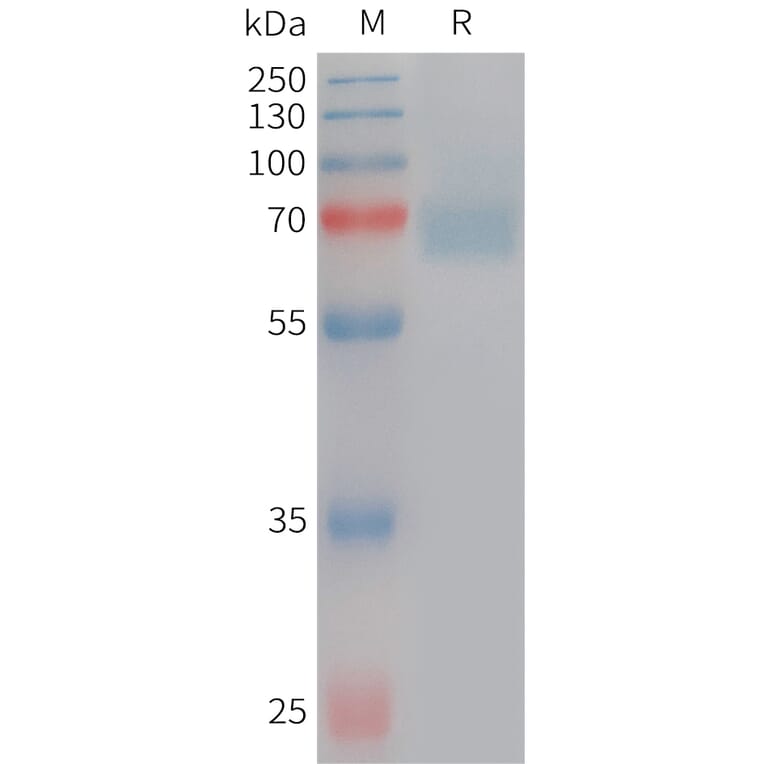 SDS-PAGE - Recombinant Human Acetylcholinesterase Protein (6×His Tag) (A317748) - Antibodies.com