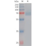 SDS-PAGE - Recombinant Human Acetylcholinesterase Protein (6×His Tag) (A317748) - Antibodies.com