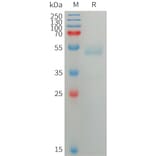 SDS-PAGE - Recombinant Human ANGPTL7 Protein (6×His Tag) (A317749) - Antibodies.com