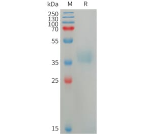 SDS-PAGE - Recombinant Human Azurocidin Protein (6×His Tag) (A317750) - Antibodies.com