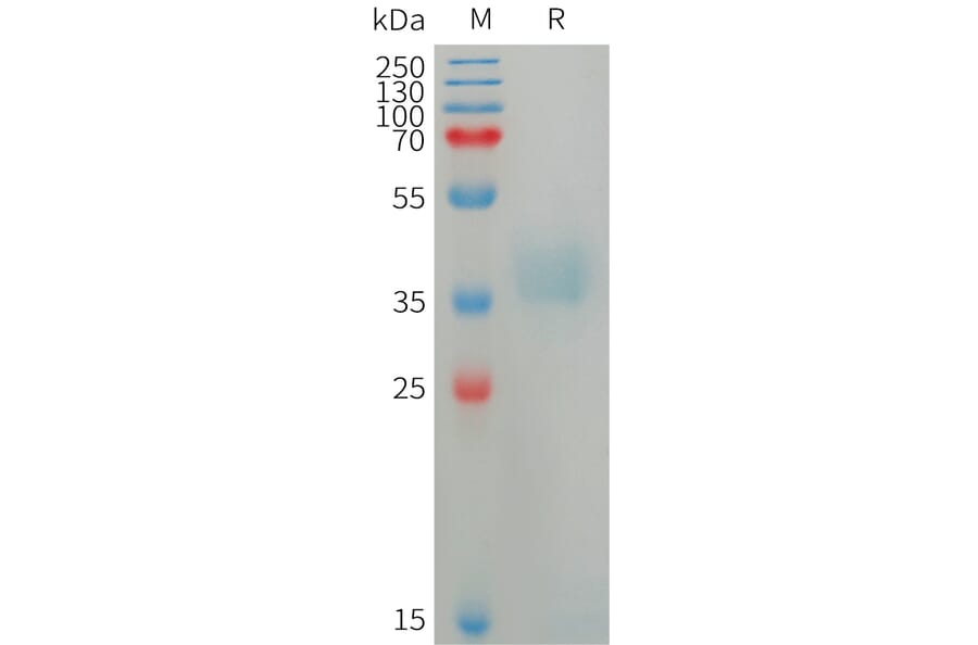 SDS-PAGE - Recombinant Human Azurocidin Protein (6×His Tag) (A317750) - Antibodies.com