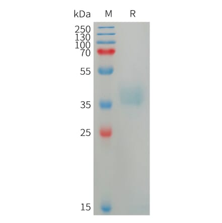 SDS-PAGE - Recombinant Human Azurocidin Protein (6×His Tag) (A317750) - Antibodies.com