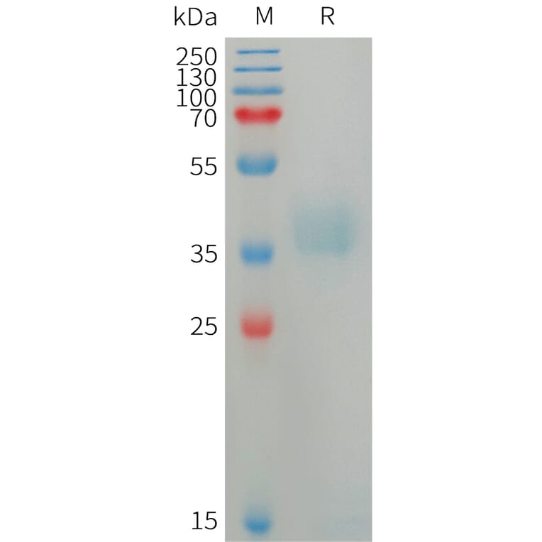 SDS-PAGE - Recombinant Human Azurocidin Protein (6×His Tag) (A317750) - Antibodies.com