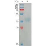 SDS-PAGE - Recombinant Human Azurocidin Protein (6×His Tag) (A317750) - Antibodies.com