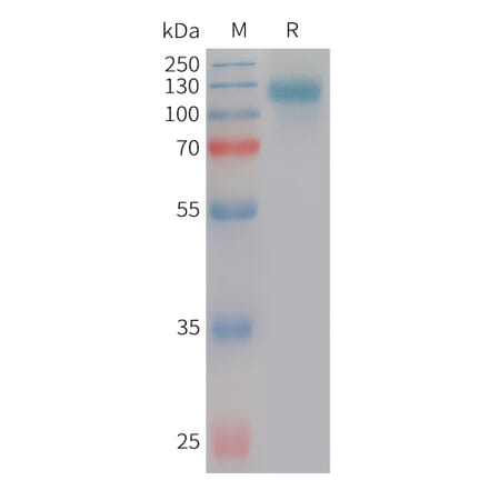 SDS-PAGE - Recombinant Human SEZ6L2 Protein (6×His Tag) (A317751) - Antibodies.com