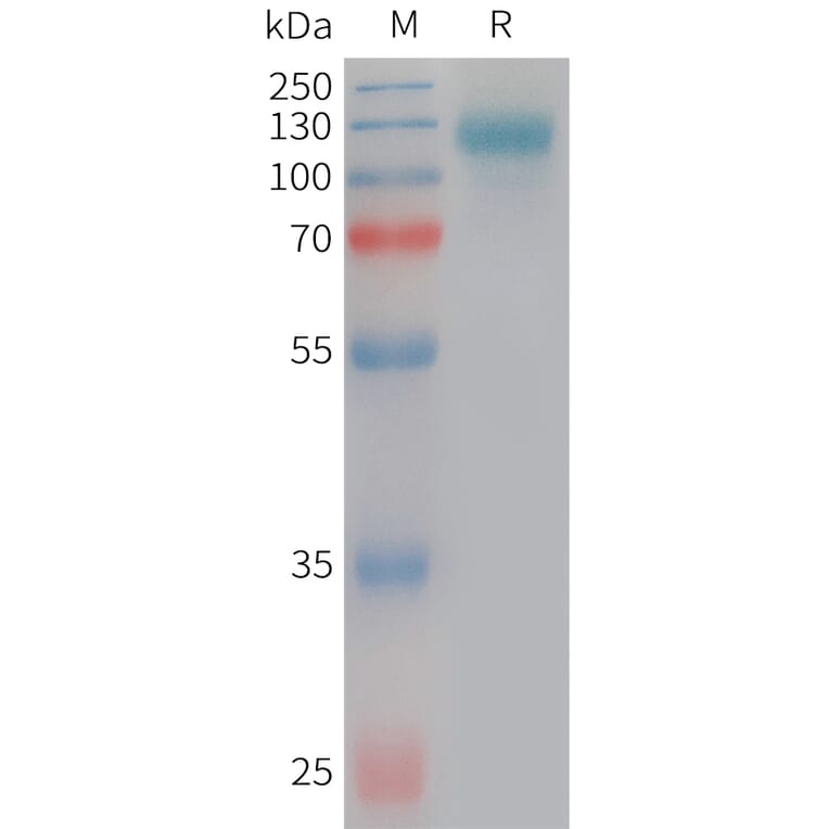 SDS-PAGE - Recombinant Human SEZ6L2 Protein (6×His Tag) (A317751) - Antibodies.com