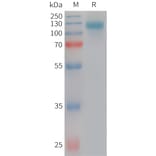 SDS-PAGE - Recombinant Human SEZ6L2 Protein (6×His Tag) (A317751) - Antibodies.com