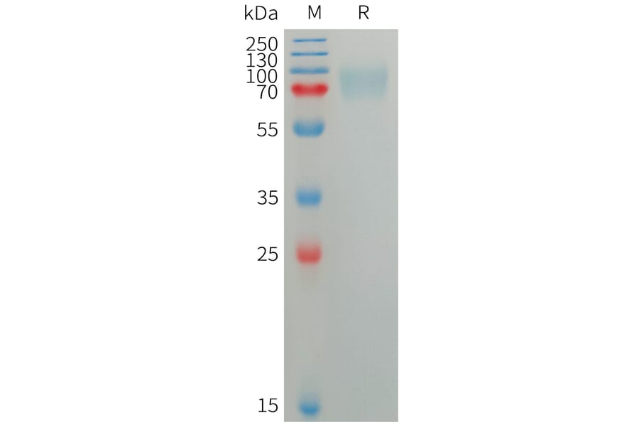SDS-PAGE - Recombinant Human SIGLEC5 Protein (6×His Tag) (A317752) - Antibodies.com