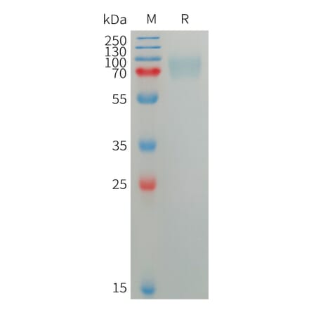 SDS-PAGE - Recombinant Human SIGLEC5 Protein (6×His Tag) (A317752) - Antibodies.com