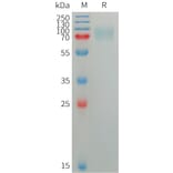 SDS-PAGE - Recombinant Human SIGLEC5 Protein (6×His Tag) (A317752) - Antibodies.com
