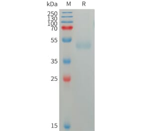 SDS-PAGE - Recombinant Human CD172 gamma Protein (6×His Tag) (A317753) - Antibodies.com