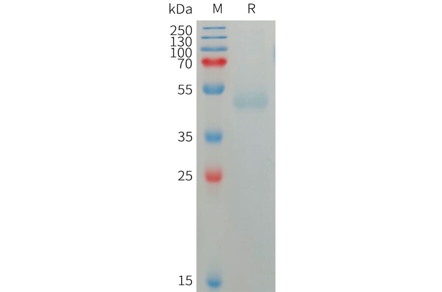 SDS-PAGE - Recombinant Human CD172 gamma Protein (6×His Tag) (A317753) - Antibodies.com