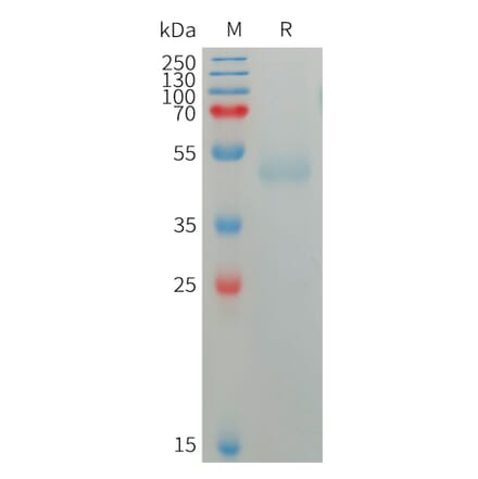 SDS-PAGE - Recombinant Human CD172 gamma Protein (6×His Tag) (A317753) - Antibodies.com