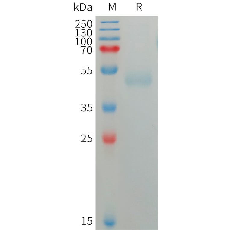 SDS-PAGE - Recombinant Human CD172 gamma Protein (6×His Tag) (A317753) - Antibodies.com