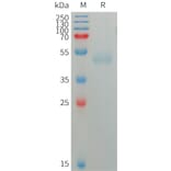 SDS-PAGE - Recombinant Human CD172 gamma Protein (6×His Tag) (A317753) - Antibodies.com
