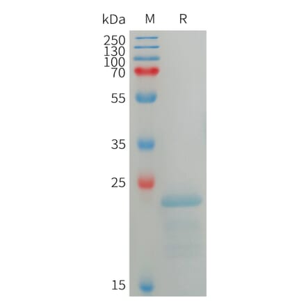 SDS-PAGE - Recombinant Human SP17 Protein (6×His Tag) (A317754) - Antibodies.com