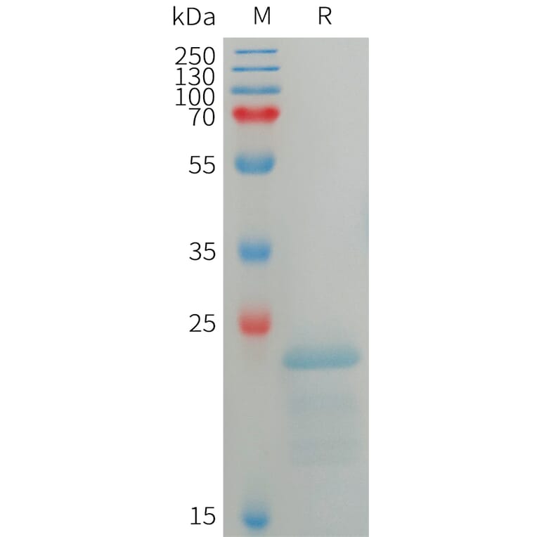 SDS-PAGE - Recombinant Human SP17 Protein (6×His Tag) (A317754) - Antibodies.com