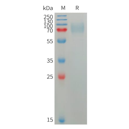 SDS-PAGE - Recombinant Human Plxdc2 Protein (6×His Tag) (A317755) - Antibodies.com