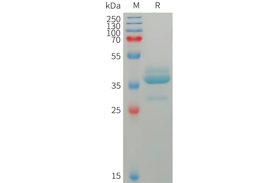 SDS-PAGE - Recombinant Human Estrogen Inducible Protein pS2 Protein (Fc Tag) (A317756) - Antibodies.com