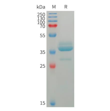 SDS-PAGE - Recombinant Human Estrogen Inducible Protein pS2 Protein (Fc Tag) (A317756) - Antibodies.com