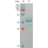 SDS-PAGE - Recombinant Human Estrogen Inducible Protein pS2 Protein (Fc Tag) (A317756) - Antibodies.com