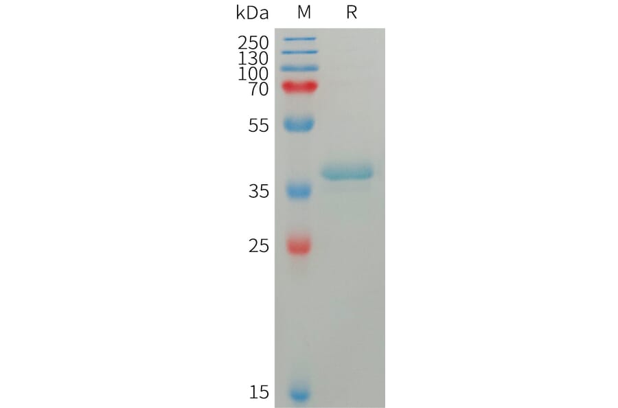 SDS-PAGE - Recombinant Human S100A4 Protein (Fc Tag) (A317757) - Antibodies.com