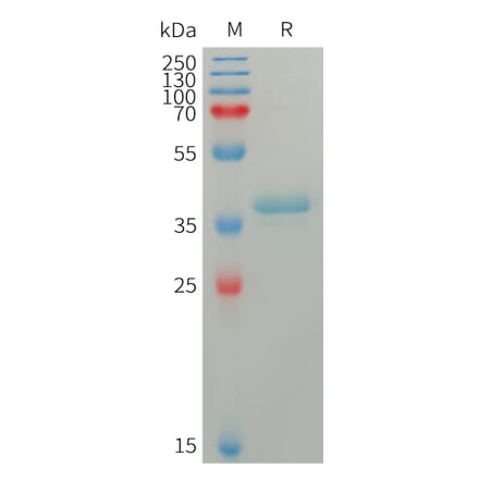 SDS-PAGE - Recombinant Human S100A4 Protein (Fc Tag) (A317757) - Antibodies.com