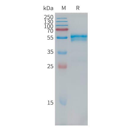 SDS-PAGE - Recombinant Human BMPR1A Protein (Fc Tag) (A317758) - Antibodies.com