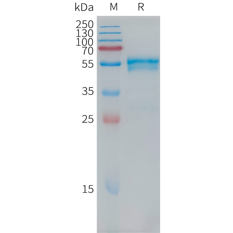 SDS-PAGE - Recombinant Human BMPR1A Protein (Fc Tag) (A317758) - Antibodies.com