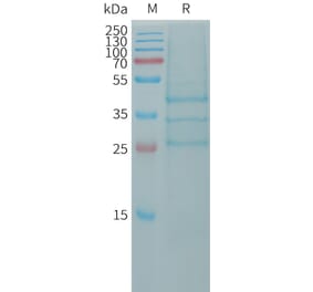 SDS-PAGE - Recombinant Human BMP2 Protein (Fc Tag) (A317759) - Antibodies.com