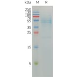 SDS-PAGE - Recombinant Human SEPP1 Protein (3×Flag Tag) (A317760) - Antibodies.com