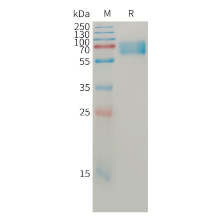 SDS-PAGE - Recombinant Human BACE1 Protein (6×His Tag) (A317761) - Antibodies.com