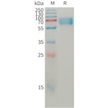 SDS-PAGE - Recombinant Human BACE1 Protein (6×His Tag) (A317761) - Antibodies.com