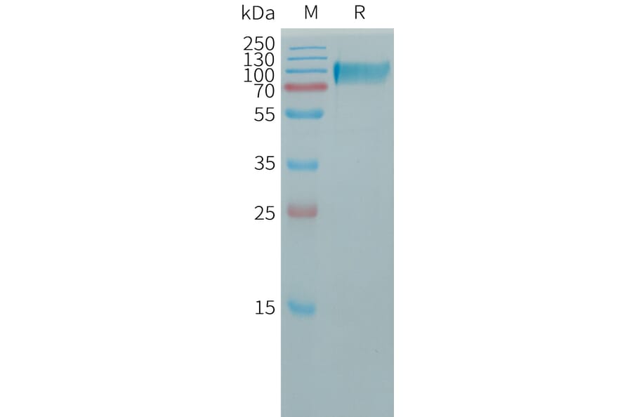 SDS-PAGE - Recombinant Human Butyrylcholinesterase Protein (6×His Tag) (A317762) - Antibodies.com