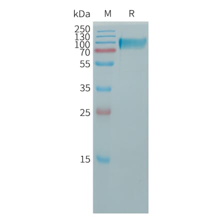 SDS-PAGE - Recombinant Human Butyrylcholinesterase Protein (6×His Tag) (A317762) - Antibodies.com