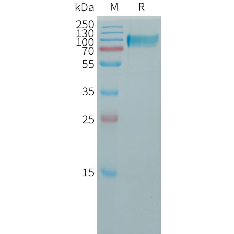 SDS-PAGE - Recombinant Human Butyrylcholinesterase Protein (6×His Tag) (A317762) - Antibodies.com