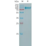 SDS-PAGE - Recombinant Human Butyrylcholinesterase Protein (6×His Tag) (A317762) - Antibodies.com