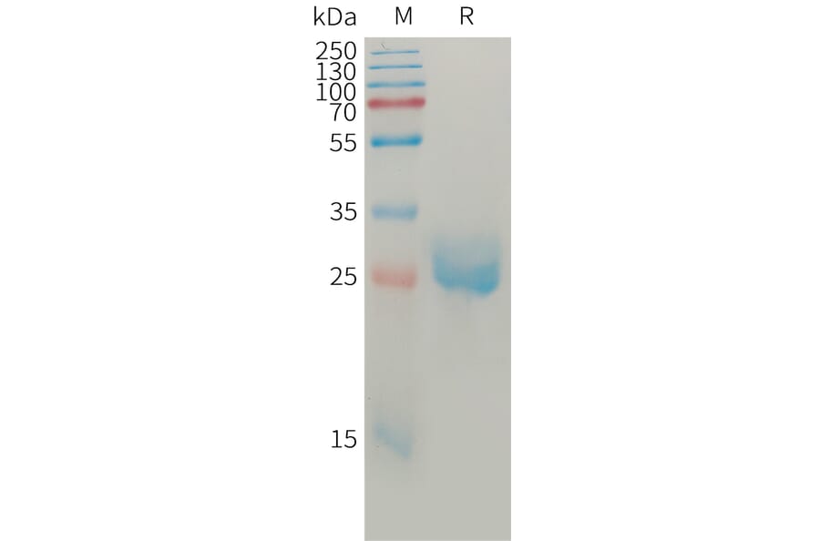 SDS-PAGE - Recombinant Human Angiopoietin 2/ANG2 Protein (6×His Tag) (A317763) - Antibodies.com