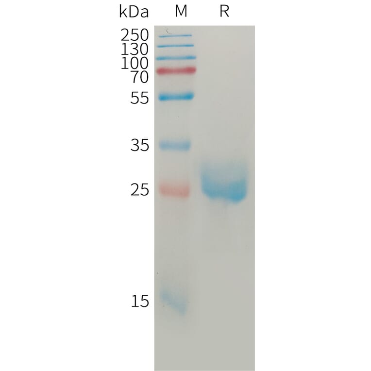 SDS-PAGE - Recombinant Human Angiopoietin 2/ANG2 Protein (6×His Tag) (A317763) - Antibodies.com