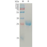 SDS-PAGE - Recombinant Human Angiopoietin 2/ANG2 Protein (6×His Tag) (A317763) - Antibodies.com