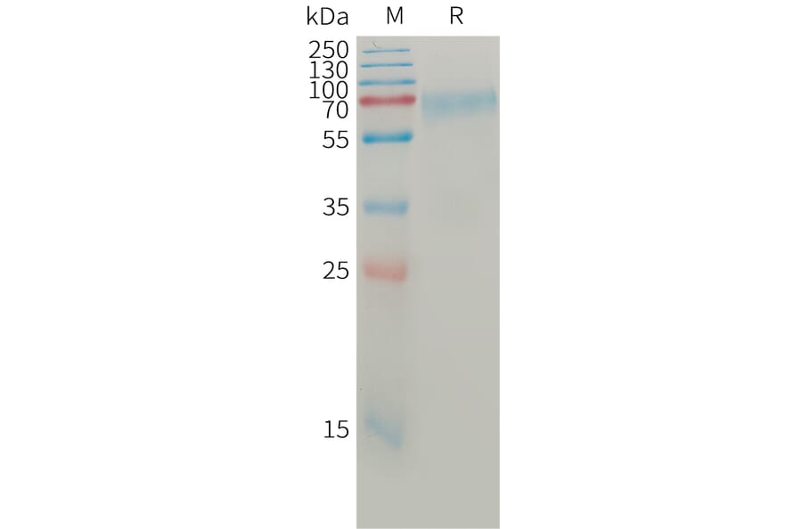 SDS-PAGE - Recombinant Human Angiopoietin 2/ANG2 Protein (6×His Tag) (A317764) - Antibodies.com